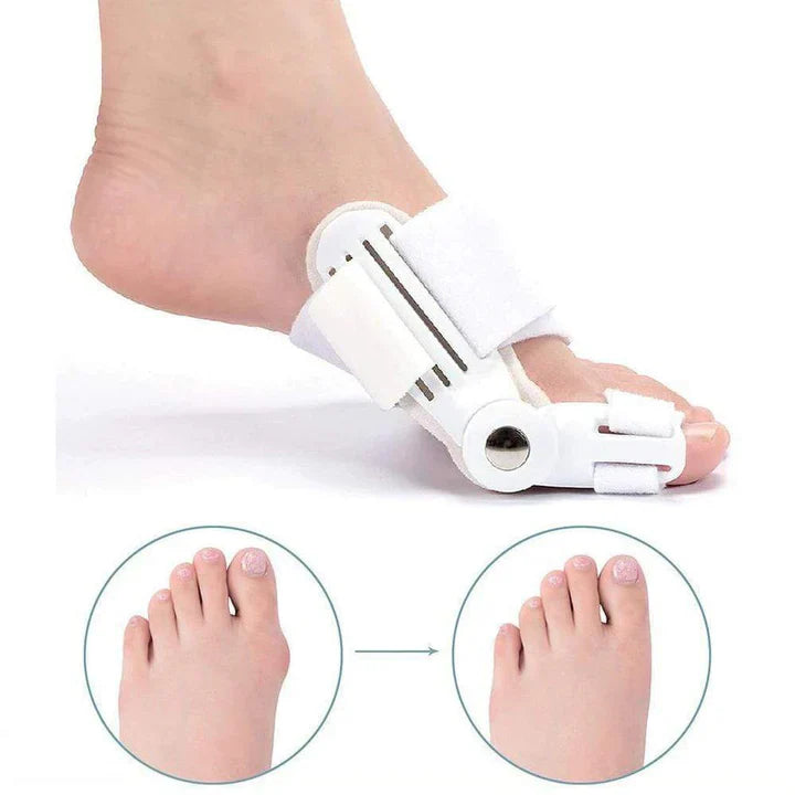 Hallux Valgus Correctiespalk ( 1 Paar )