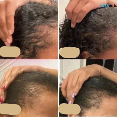 Vegan Haargroei-olie | Natuurlijke Booster voor Gezonde Haargroei