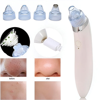 2-in-1 Poriënreiniger en Microdermabrasieapparaat