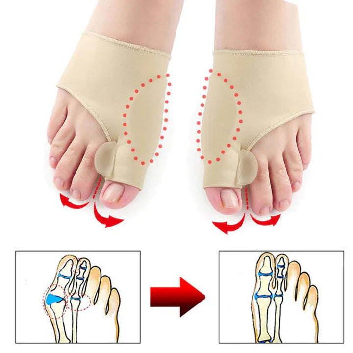 Hallux Valgus Correctiebescherming ( 1 Paar )