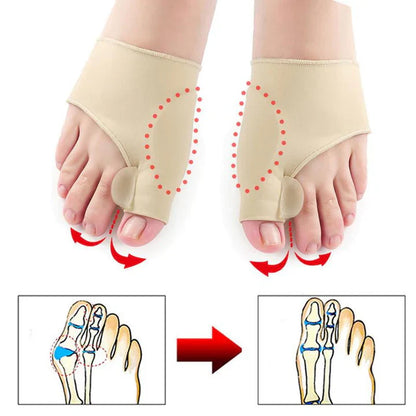 Hallux Valgus Correctiebescherming ( 1 Paar )